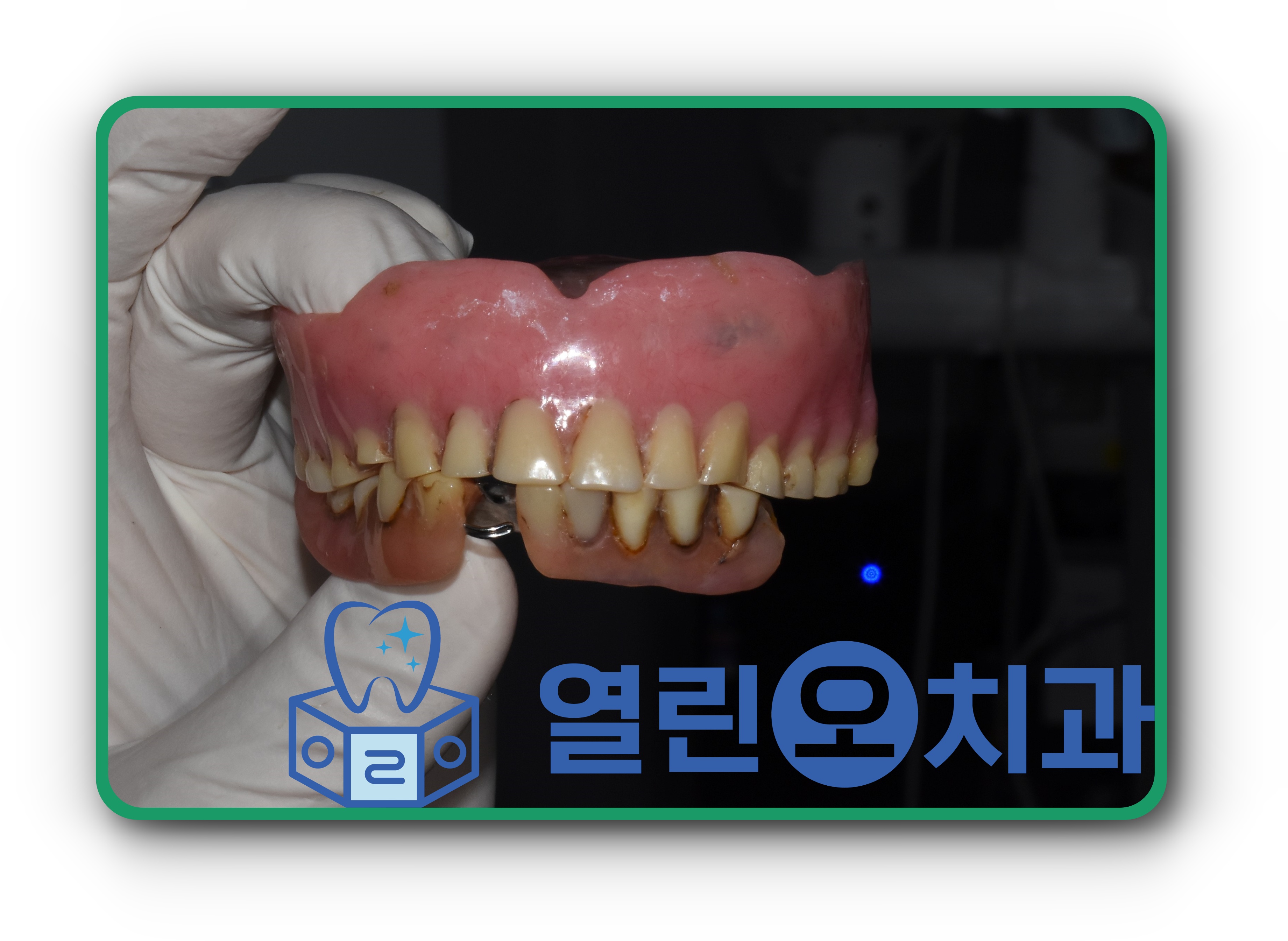 치료전, 정면